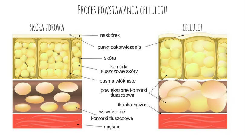 gabinet kosmetyczny Wrocław cellulit proces powstawania