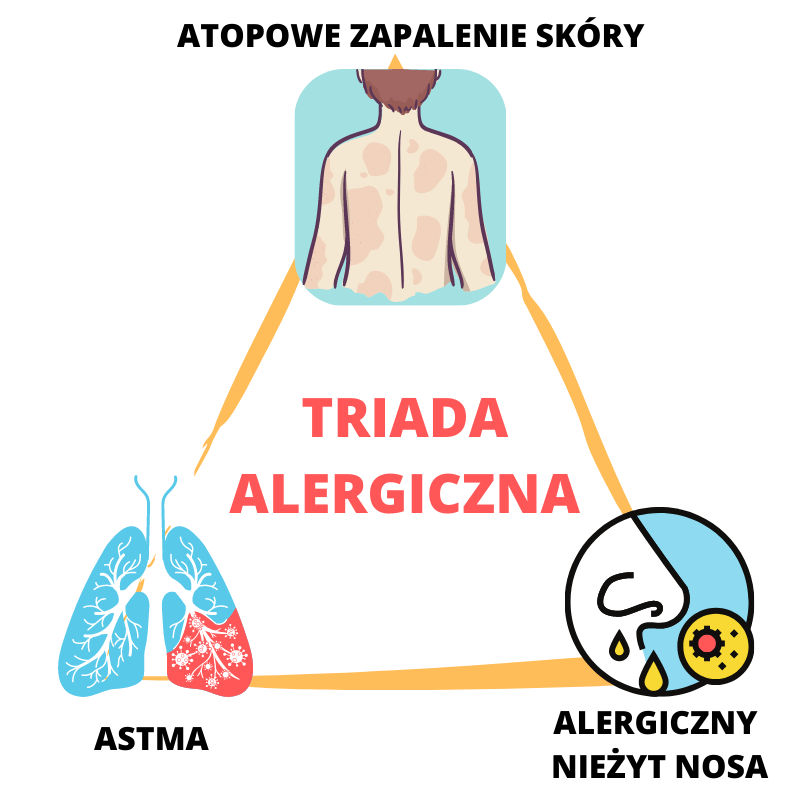 triada alergiczna AZS nieżyt nosa astma