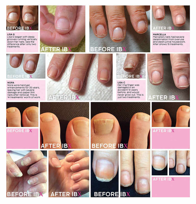 manicure wrocław ibx przed i po