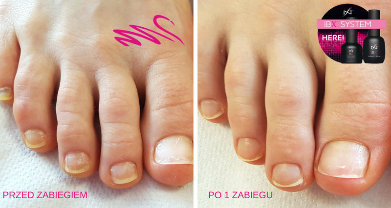 pedicure ibx wroclaw regeneracja paznokci gabinet kosmetyczny poczucie piekna www